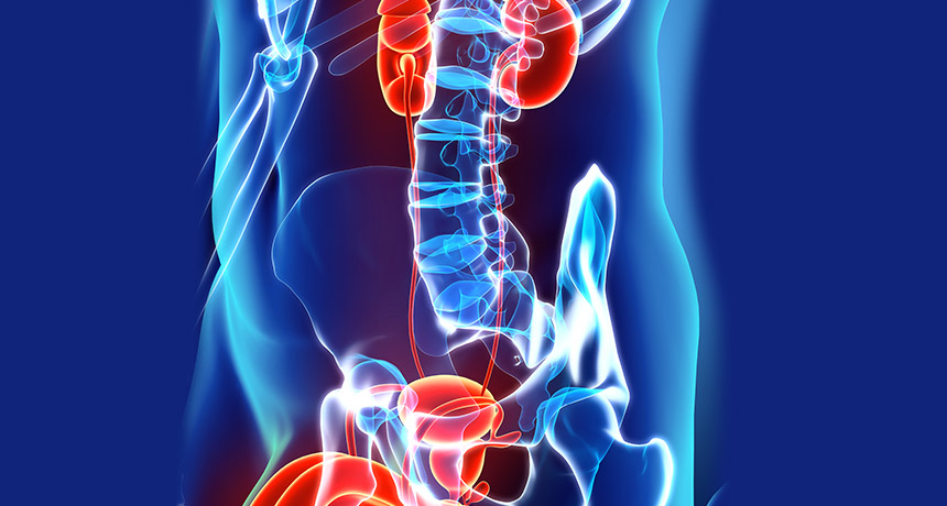 Cáncer de pulmón