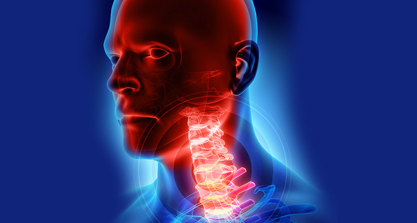 Cáncer de pulmón