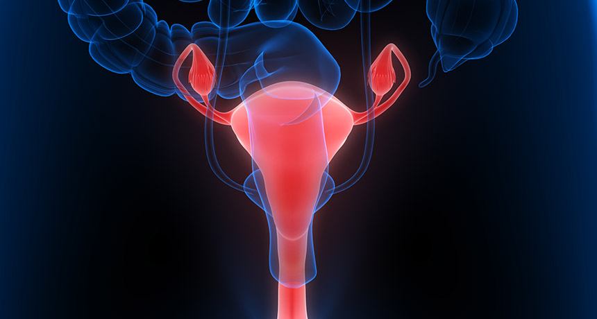 Cáncer de pulmón
